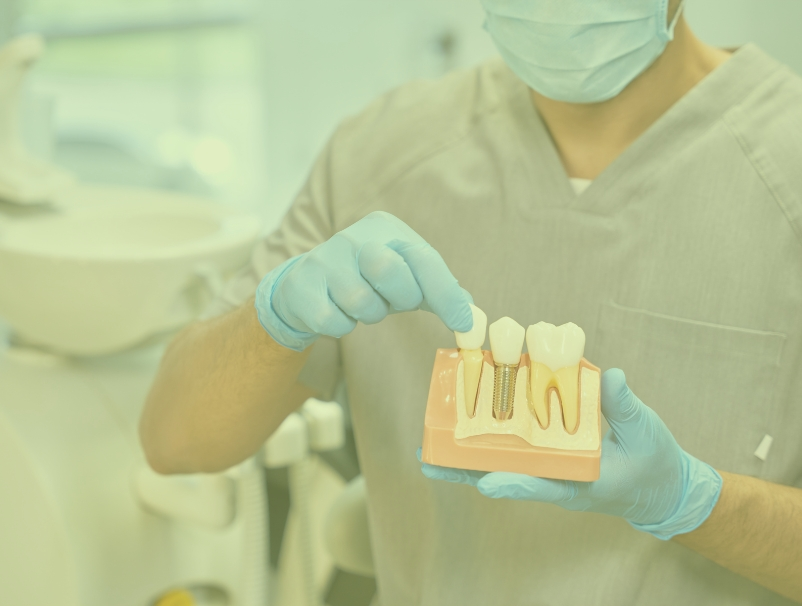 Dental Implants Treatment